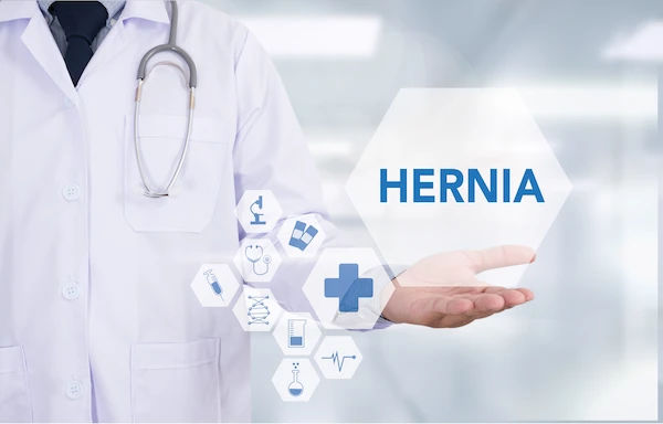 Umbilical Hernia Overview and Information